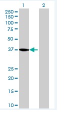 Western blot - Anti-WDR68 antibody (AB70148)