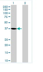 Western blot - Anti-WDR68 antibody (AB70148)
