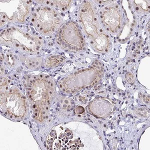 Immunohistochemistry (Formalin/PFA-fixed paraffin-embedded sections) - Anti-WDR72 antibody (AB188518)