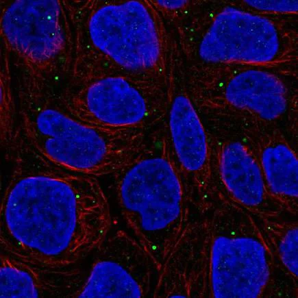 Immunocytochemistry/ Immunofluorescence - Anti-WDR72 antibody (AB222307)