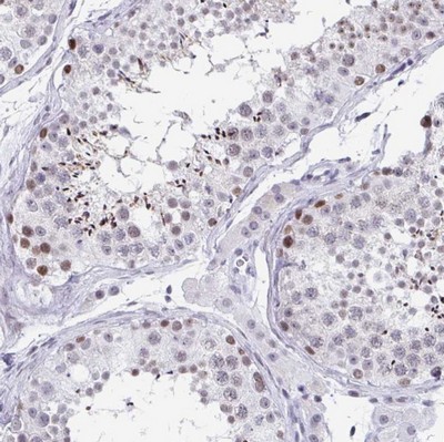 Immunohistochemistry (Formalin/PFA-fixed paraffin-embedded sections) - Anti-WDR72 antibody - C-terminal (AB190268)