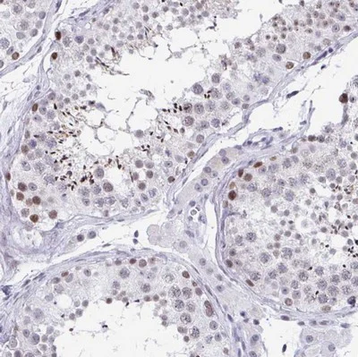 Immunohistochemistry (Formalin/PFA-fixed paraffin-embedded sections) - Anti-WDR72 antibody - C-terminal (AB190268)