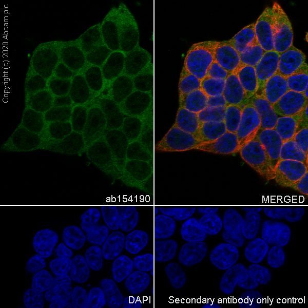 Immunocytochemistry/ Immunofluorescence - Anti-WDR77 antibody [EPR10708(B)] (AB154190), expandable thumbnail