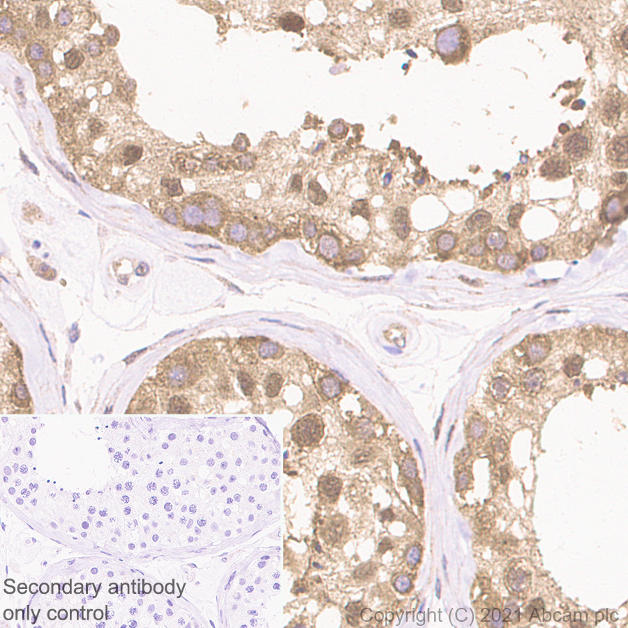 Immunohistochemistry (Formalin/PFA-fixed paraffin-embedded sections) - Anti-WDR77 antibody [EPR10708(B)] (AB154190), expandable thumbnail
