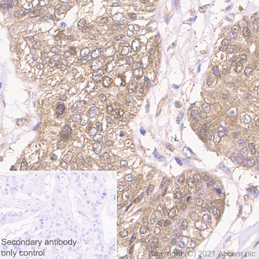 Immunohistochemistry (Formalin/PFA-fixed paraffin-embedded sections) - Anti-WDR77 antibody [EPR10708(B)] (AB154190), expandable thumbnail