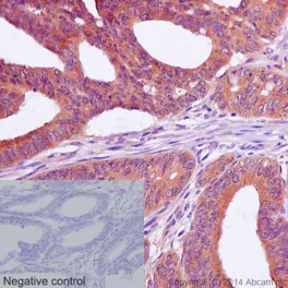 Immunohistochemistry (Formalin/PFA-fixed paraffin-embedded sections) - Anti-WDR77 antibody [EPR10709(2)] - C-terminal (AB190361)