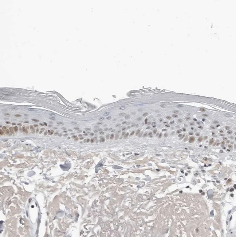 Immunohistochemistry (Formalin/PFA-fixed paraffin-embedded sections) - Anti-WDR79 antibody (AB224444)