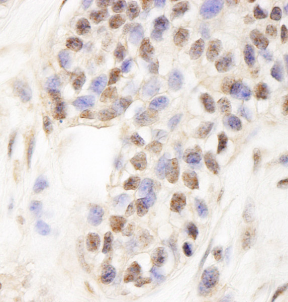 Immunohistochemistry (Formalin/PFA-fixed paraffin-embedded sections) - Anti-WDR79 antibody (AB99376)