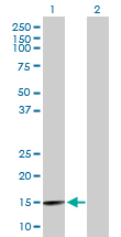 Western blot - Anti-WDR9/BRWD1 antibody (AB169597), expandable thumbnail