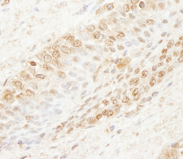 Immunohistochemistry (Formalin/PFA-fixed paraffin-embedded sections) - Anti-WDR91 antibody (AB80614), expandable thumbnail