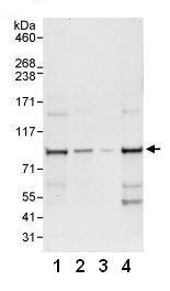 Western blot - Anti-WDR91 antibody (AB80614), expandable thumbnail
