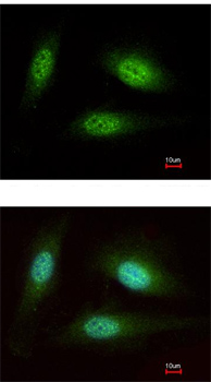 Immunocytochemistry/ Immunofluorescence - Anti-WDR91 antibody - N-terminal (AB153955), expandable thumbnail