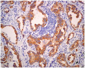 Immunohistochemistry (Formalin/PFA-fixed paraffin-embedded sections) - Anti-WDTC1 antibody [EPR12504] (AB174294)