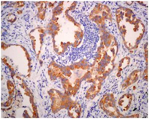 Immunohistochemistry (Formalin/PFA-fixed paraffin-embedded sections) - Anti-WDTC1 antibody [EPR12504] - BSA and Azide free (AB249799)