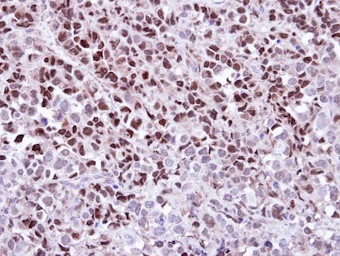 Immunohistochemistry (Formalin/PFA-fixed paraffin-embedded sections) - Anti-Wee1 antibody (AB137377), expandable thumbnail