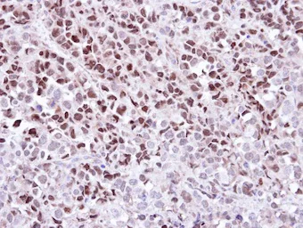 Immunohistochemistry (Formalin/PFA-fixed paraffin-embedded sections) - Anti-Wee1 antibody (AB137377)