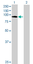 Western blot - Wee1 overexpression 293T lysate (whole cell) (AB94212)