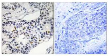 Immunohistochemistry (Formalin/PFA-fixed paraffin-embedded sections) - Anti-Wee1 (phospho S53) antibody (AB111820)
