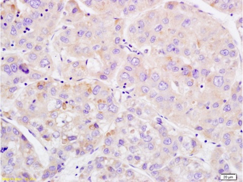 Immunohistochemistry (Formalin/PFA-fixed paraffin-embedded sections) - Anti-Wee1 (phospho S642) antibody (AB203213)