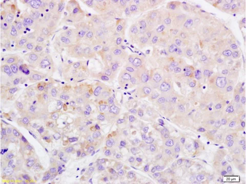 Immunohistochemistry (Formalin/PFA-fixed paraffin-embedded sections) - Anti-Wee1 (phospho S642) antibody (AB203213)