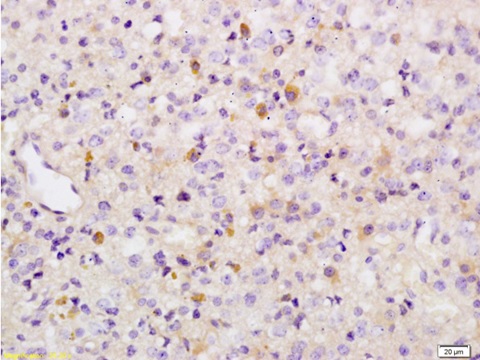 Immunohistochemistry (Formalin/PFA-fixed paraffin-embedded sections) - Anti-Wee1 (phospho S642) antibody (AB203213)