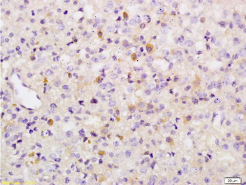 Immunohistochemistry (Formalin/PFA-fixed paraffin-embedded sections) - Anti-Wee1 (phospho S642) antibody (AB203213)