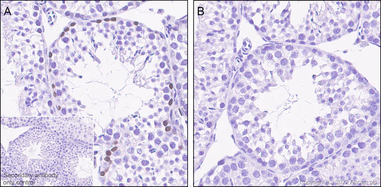 Immunohistochemistry (Formalin/PFA-fixed paraffin-embedded sections) - Anti-Wee1 (phospho S642) antibody [EPR27036-80] (AB307515)