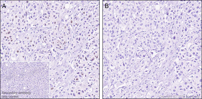 Immunohistochemistry (Formalin/PFA-fixed paraffin-embedded sections) - Anti-Wee1 (phospho S642) antibody [EPR27036-80] - BSA and Azide free (AB307516)
