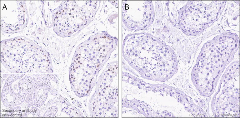 Immunohistochemistry (Formalin/PFA-fixed paraffin-embedded sections) - Anti-Wee1 (phospho S642) antibody [EPR27036-80] - BSA and Azide free (AB307516)