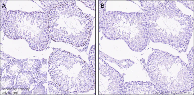 Immunohistochemistry (Formalin/PFA-fixed paraffin-embedded sections) - Anti-Wee1 (phospho S642) antibody [EPR27036-80] - BSA and Azide free (AB307516)