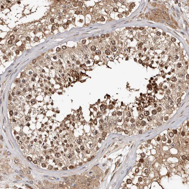 Immunohistochemistry (Formalin/PFA-fixed paraffin-embedded sections) - Anti-WEE2 antibody (AB121943)