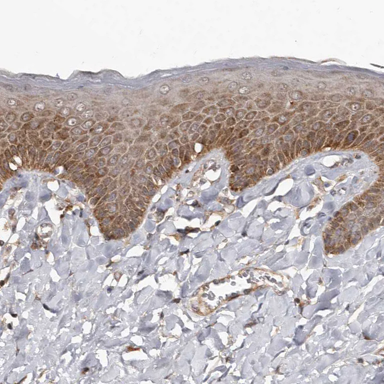 Immunohistochemistry (Formalin/PFA-fixed paraffin-embedded sections) - Anti-WEE2 antibody (AB121943)