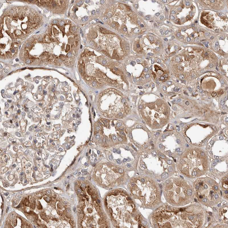 Immunohistochemistry (Formalin/PFA-fixed paraffin-embedded sections) - Anti-WEE2 antibody (AB121943)