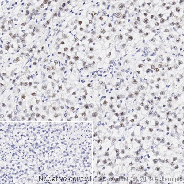 Immunohistochemistry (Formalin/PFA-fixed paraffin-embedded sections) - Anti-Werner's syndrome helicase WRN antibody [195C] (AB241545)