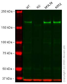 Western blot - Anti-Werner's syndrome helicase WRN antibody [195C] (AB241545), expandable thumbnail