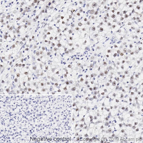 Immunohistochemistry (Formalin/PFA-fixed paraffin-embedded sections) - Anti-Werner's syndrome helicase WRN antibody [195C] - BSA and Azide free (AB252781), expandable thumbnail