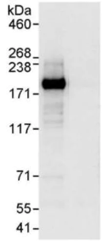 Immunoprecipitation - Anti-Werner's syndrome helicase WRN antibody (AB17987)