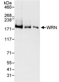 Western blot - Anti-Werner's syndrome helicase WRN antibody (AB17987)