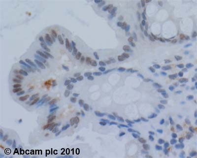 Immunohistochemistry (Formalin/PFA-fixed paraffin-embedded sections) - Anti-Werner's syndrome helicase WRN antibody (AB200), expandable thumbnail