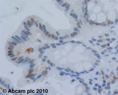 Immunohistochemistry (Formalin/PFA-fixed paraffin-embedded sections) - Anti-Werner's syndrome helicase WRN antibody (AB200)