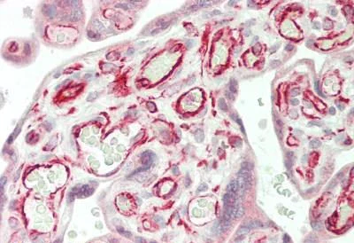 Immunohistochemistry (Formalin/PFA-fixed paraffin-embedded sections) - Anti-Werner's syndrome helicase WRN antibody (AB230851)
