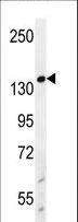 Western blot - Anti-Werner's syndrome helicase WRN antibody (AB230851)