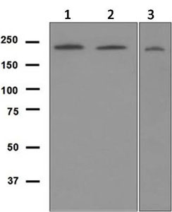 Western blot - Anti-Werner's syndrome helicase WRN antibody [EPR6392] (AB124673), expandable thumbnail
