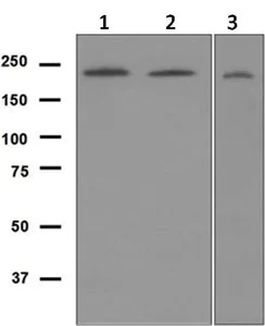 Western blot - Anti-Werner's syndrome helicase WRN antibody [EPR6392] (AB124673)