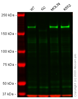 Western blot - Anti-Werner's syndrome helicase WRN antibody [EPR6392] (AB124673), expandable thumbnail