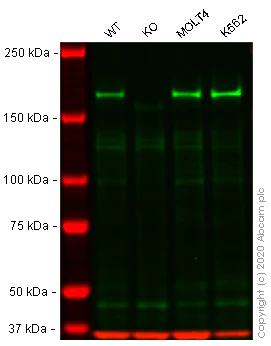 Western blot - Anti-Werner's syndrome helicase WRN antibody [EPR6392] (AB124673)