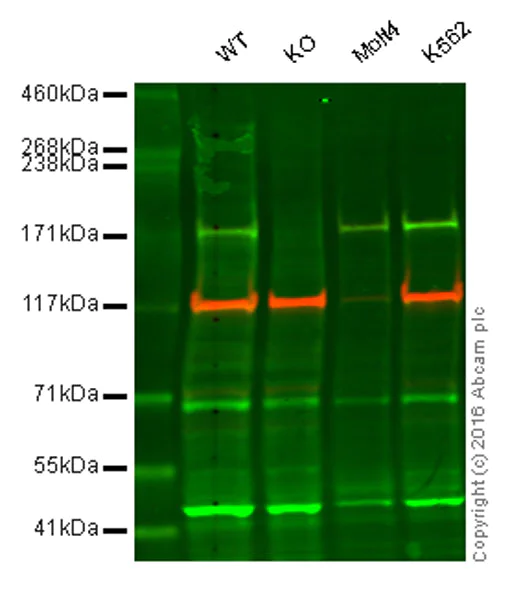 Western blot - Anti-Werner's syndrome helicase WRN antibody [EPR6392] (AB124673)