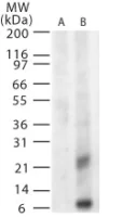 Western blot - Anti-West Nile Virus M glycoprotein antibody (AB22070)