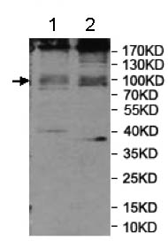 Western blot - Anti-WFS1 antibody (AB176909)