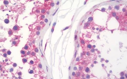 Immunohistochemistry (Formalin/PFA-fixed paraffin-embedded sections) - Anti-WFS1 antibody (AB230512)